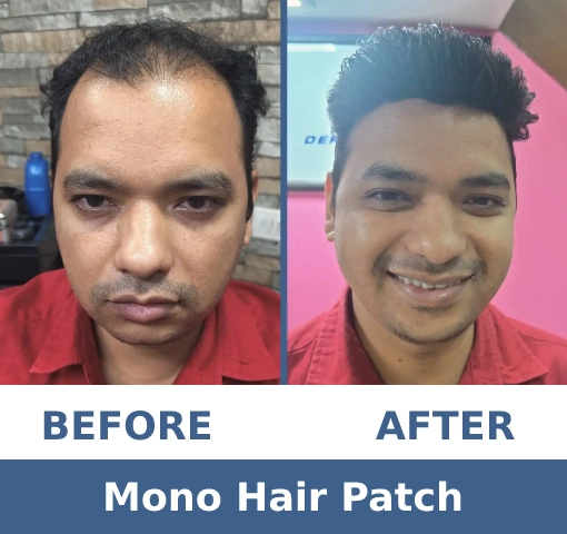 Dermecare-HP-Slider-1