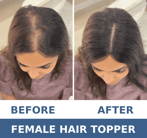 Dermecare-HP-Slider-1