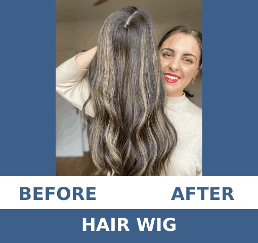 Dermecare-HP-Slider-1